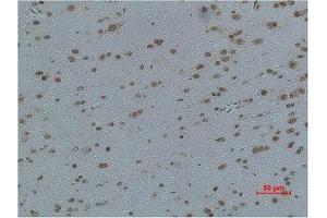 Immunohistochemical analysis of paraffin-embedded Rat Brain Tissue using L-type Ca++ CP γ4 Polyclonal Antibody. (CACNG4 抗体)