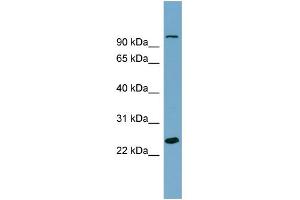 WB Suggested Anti-SEMA3D Antibody Titration: 0. (SEMA3D 抗体  (Middle Region))