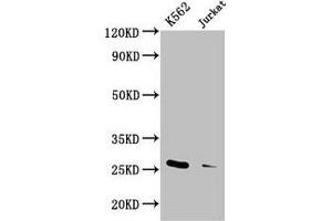 Western Blot Positive WB detected in: K562 whole cell lysate, Jurkat whole cell lysate All lanes: MOB1A antibody at 3. (MOB1A 抗体  (AA 2-216))