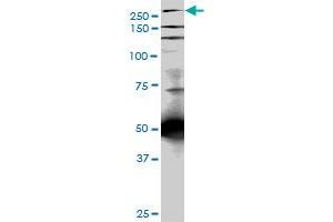 TLN1 monoclonal antibody (M05), clone 5C1. (TLN1 抗体  (AA 1052-1149))