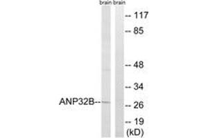 Western blot analysis of extracts from rat brain cells, using ANP32B Antibody.