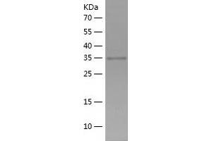 Western Blotting (WB) image for Galectin 4 (LGALS4) (AA 1-326) protein (His-IF2DI Tag) (ABIN7123046)