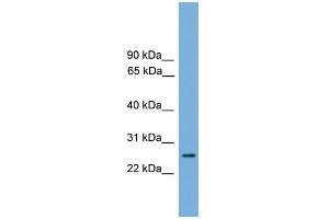 WB Suggested Anti-RAB35 Antibody Titration: 0.