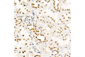 Immunohistochemistry of paraffin-embedded rat ovary using H4K8ac antibody (ABIN7267747) at dilution of 1:100 (40x lens). (Histone H4 抗体  (acLys8))