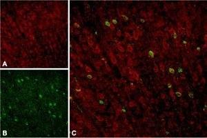 Expression of Sortilin in rat neocortex - Immunohistochemical staining of rat neocortex with Anti-Sortilin (extracellular) Antibody (ABIN7043768, ABIN7044759 and ABIN7044760). (Sortilin 1 抗体  (Extracellular Domain))