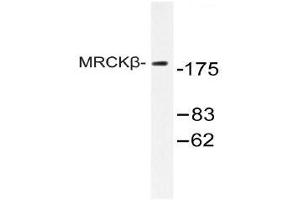 Western blot (WB) analysis of MRCKβ antibody in extracts from COLO cell. (CDC42BPB 抗体)