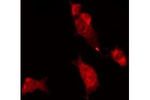 ABIN6275434 staining MCF7 by IF/ICC. (RAB11FIP2 抗体  (Internal Region))