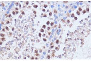 Immunohistochemistry of paraffin-embedded Mouse testis using BRD4 Polyclonal Antibody at dilution of 1:100 (40x lens). (BRD4 抗体)