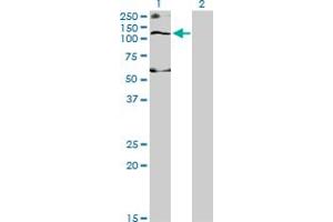Western Blotting (WB) image for anti-Solute Carrier Family 12 (Potassium-Chloride Transporter) Member 4 (SLC12A4) (AA 1-110) antibody (ABIN562896)