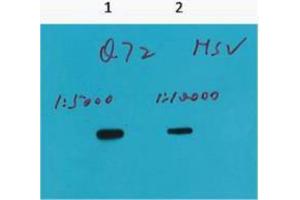 Western Blotting (WB) image for anti-HSV Tag antibody (ABIN3181183) (HSV Tag 抗体)