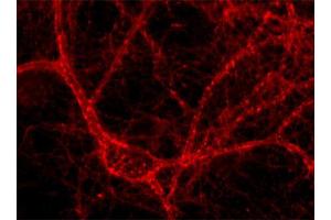 Immunocytochemistry on cultured hippocampus neurons (dilution 1 : 500). (Amphiphysin 抗体  (AA 2-15))