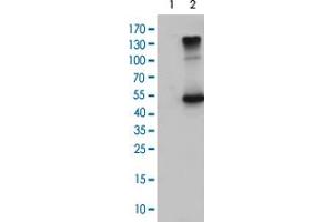 Western Blot analysis of HEK293T cells (Lane 1: transfected with pCMV6-ENTRY control and Lane 2: transfected with pCMV6-ENTRY EFEMP1 cDNA) with EFEMP1 monoclonal antibody, clone 1D9 . (FBLN3 抗体)