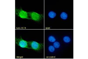 (ABIN185551) Immunofluorescence analysis of paraformaldehyde fixed A431 cells, permeabilized with 0. (OGFR 抗体  (C-Term))