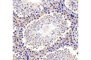 Immunohistochemistry analysis of paraffin-embedded mouse brain using TESK1 (ABIN7075866) at dilution of 1: 500 (TESK1 抗体)