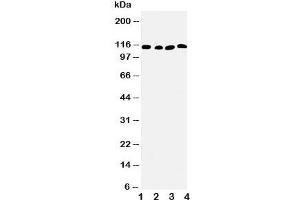 Western blot testing of SERCA2 ATPase antibody and Lane 1:  rat skeletal muscle;  2: rat kidney;  3: human PANC;  4: SMMC-7721 cell lysate. (SERCA2 ATPase (Middle Region) 抗体)