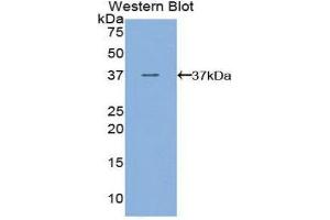 Western Blotting (WB) image for anti-Fms-Related Tyrosine Kinase 4 (FLT4) (AA 30-326) antibody (ABIN3205873) (FLT4 抗体  (AA 30-326))