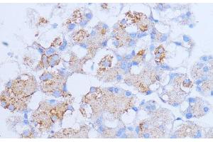 Immunohistochemistry of paraffin-embedded Rat pancreas using NME6 Polyclonal Antibody at dilution of 1:100 (40x lens). (NME6 抗体)