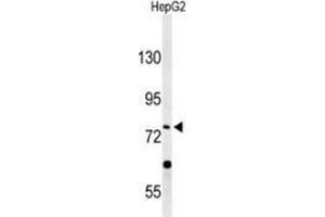 PLA2G6 antibody  (Middle Region)