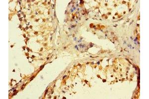 Immunohistochemistry of paraffin-embedded human testis tissue using ABIN7150223 at dilution of 1:100 (POLB 抗体  (AA 1-300))