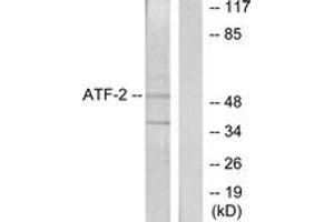 Western Blotting (WB) image for anti-Activating Transcription Factor 2 (ATF2) (AA 29-78) antibody (ABIN2888949) (ATF2 抗体  (AA 29-78))