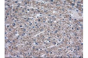 Immunohistochemical staining of paraffin-embedded Human liver tissue using anti-TBXAS1 mouse monoclonal antibody. (TBXAS1 抗体)