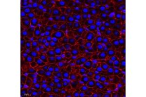 Immunofluorescence (Paraffin-embedded Sections) (IF (p)) image for anti-threonine Synthase-Like 2 (THNSL2) antibody (ABIN7075893)