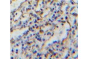 Used in DAB staining on fromalin fixed paraffin-embedded Spleen tissue