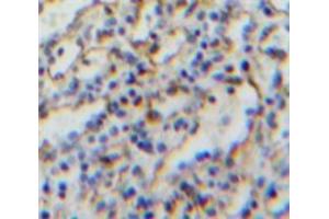 Used in DAB staining on fromalin fixed paraffin-embedded Spleen tissue (CD21 抗体  (AA 729-957))