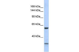 WB Suggested Anti-ZNF777 Antibody Titration:  0. (ZNF777 抗体  (N-Term))