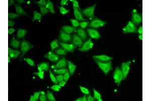Immunofluorescence analysis of HeLa cells using ATXN3 antibody. (Ataxin 3 抗体)