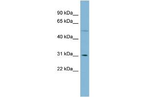WB Suggested Anti-MRPL28  Antibody Titration: 0. (MRPL28 抗体  (Middle Region))