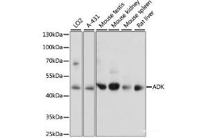 Western blot analysis of extracts of various cell lines using ADK Polyclonal Antibody at dilution of 1:1000. (ADK 抗体)