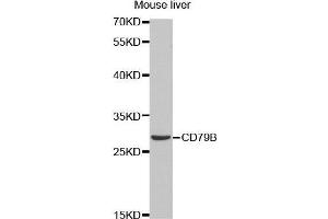 Western Blotting (WB) image for anti-CD79b Molecule, Immunoglobulin-Associated beta (CD79B) (AA 29-159) antibody (ABIN6219206) (CD79b 抗体  (AA 29-159))
