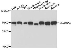 Western blot analysis of extracts of various cell lines, using SLC16A2 antibody. (SLC16A2/MCT8 抗体)