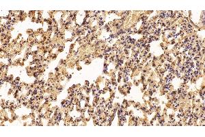 Detection of IFNa2 in Rat Lung Tissue using Polyclonal Antibody to Interferon Alpha 2 (IFNa2) (IFNA2 抗体  (AA 24-188))