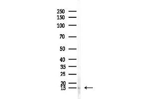 anti-SH3 Domain Binding Glutamic Acid-Rich Protein Like (SH3BGRL) (Internal Region) antibody