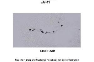 Sample Type : Frog brain Primary Antibody Dilution : 1:500 Secondary Antibody : Biotinylated goat anti-rabbit Secondary Antibody Dilution : 1:200 Color/Signal Descriptions : Black: EGR1 Gene Name : Egr1 a Submitted by : Eva Fischer, Colorado State University (EGR1 抗体  (C-Term))