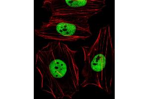 Fluorescent image of Hela cells stained with (Mouse) Smarcc1 Antibody (C-term) (ABIN6242636 and ABIN6577666).