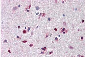 Human Brain, Cortex (formalin-fixed, paraffin-embedded) stained with ANP32A antibody ABIN461885 at 5 ug/ml followed by biotinylated goat anti-rabbit IgG secondary antibody ABIN481713, alkaline phosphatase-streptavidin and chromogen. (PHAP1 抗体  (N-Term))