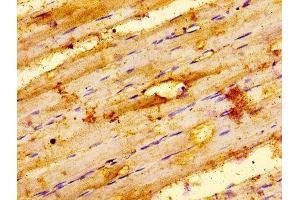 IHC image of ABIN7156505 diluted at 1:100 and staining in paraffin-embedded human skeletal muscle tissue performed on a Leica BondTM system. (ILK 抗体  (AA 1-228))