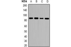 Western blot analysis of ZNF839 expression in HeLa (A), MCF7 (B), RAW264. (ZNF839 抗体)