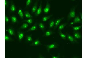 Immunofluorescence analysis of A549 cells using POLR2D antibody. (POLR2D 抗体)
