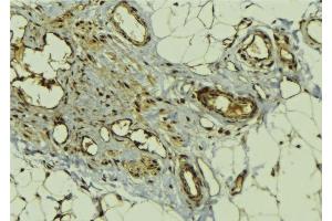anti-GLI Family Zinc Finger 3 (GLI3) (Internal Region) antibody