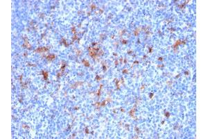 Formalin-fixed, paraffin-embedded human Tonsil stained with CD25 Mouse Monoclonal Antibody (IL2RA/2395). (CD25 抗体  (AA 42-183))