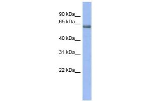 WB Suggested Anti-GABRE Antibody Titration:  0. (GABRE 抗体  (N-Term))