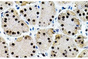 Immunohistochemistry of paraffin-embedded Human stomach using EIF4G2 Polyclonal Antibody (EIF4G2 抗体)