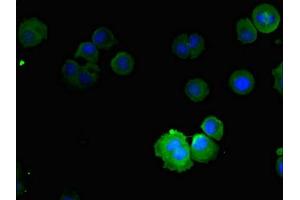 Immunofluorescent analysis of MCF-7 cells using ABIN7161014 at dilution of 1:100 and Alexa Fluor 488-congugated AffiniPure Goat Anti-Rabbit IgG(H+L) (NOX5 抗体  (AA 661-765))