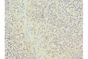 Immunohistochemistry of paraffin-embedded human tonsil tissue using ABIN7161949 at dilution of 1:100 (NUTF2 抗体  (AA 1-127))