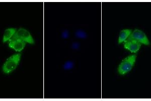 Detection of GCSFR in Human MCF7 cell using Polyclonal Antibody to Colony Stimulating Factor Receptor, Granulocyte (GCSFR) (CSF3R 抗体  (AA 26-138))