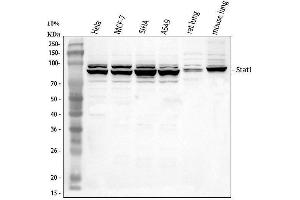 Western blot analysis of STAT1 using anti-STAT1 antibody (ABIN3043938).